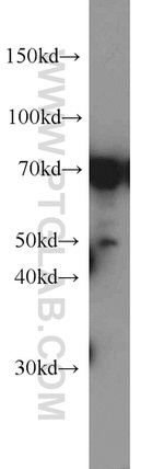 DNAJC2/MPP11 Antibody in Western Blot (WB)