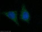 TIMM13 Antibody in Immunocytochemistry (ICC/IF)