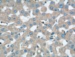 TIMM13 Antibody in Immunohistochemistry (Paraffin) (IHC (P))