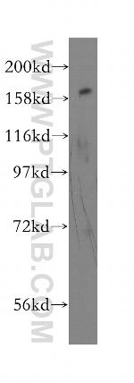 FANCA Antibody in Western Blot (WB)