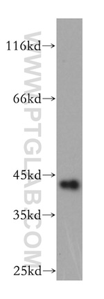 GDAP1L1 Antibody in Western Blot (WB)