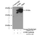 GNB4 Antibody in Immunoprecipitation (IP)