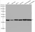 GNB4 Antibody in Western Blot (WB)