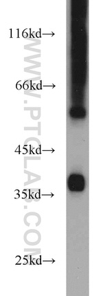 GNB4 Antibody in Western Blot (WB)