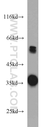 GNB4 Antibody in Western Blot (WB)