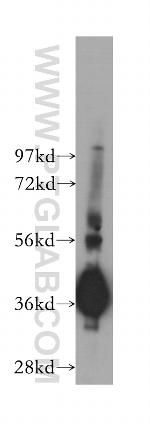 GNB4 Antibody in Western Blot (WB)