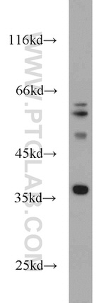GNB4 Antibody in Western Blot (WB)