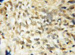 ROBO3 Antibody in Immunohistochemistry (Paraffin) (IHC (P))