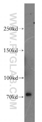 ROBO3 Antibody in Western Blot (WB)