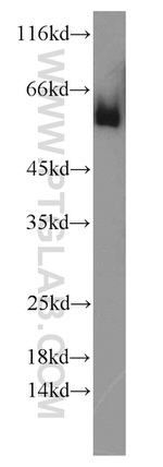 Angiotensinogen Antibody in Western Blot (WB)