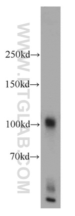 Glutamate receptor 2 Antibody in Western Blot (WB)