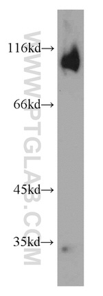 Glutamate receptor 2 Antibody in Western Blot (WB)