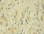 URG4 Antibody in Immunohistochemistry (Paraffin) (IHC (P))