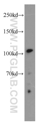 URG4 Antibody in Western Blot (WB)