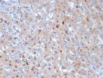 Alpha-1-Antichymotrypsin (SERPINA3) (Histiocytoma Marker) Monoclonal Antibody (SERPINA3/4190)