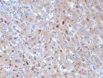 Alpha-1-Antichymotrypsin (SERPINA3) (Histiocytoma Marker) Monoclonal Antibody (SERPINA3/4190)
