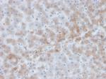 Alpha-1-Antichymotrypsin (SERPINA3) (Histiocytoma Marker) Monoclonal Antibody (SERPINA3/4184)