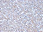 Alpha-1-Antichymotrypsin (SERPINA3) (Histiocytoma Marker) Monoclonal Antibody (SERPINA3/4185)