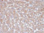 Alpha-1-Antichymotrypsin (SERPINA3) (Histiocytoma Marker) Monoclonal Antibody (SERPINA3/4189)
