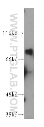 Dymeclin Antibody in Western Blot (WB)