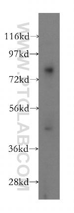 GGT5 Antibody in Western Blot (WB)