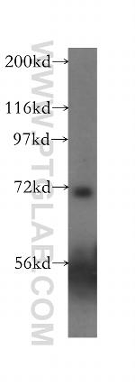 ASIC4 Antibody in Western Blot (WB)