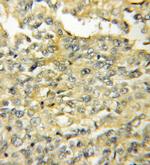 AVPI1 Antibody in Immunohistochemistry (Paraffin) (IHC (P))