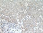 AVPI1 Antibody in Immunohistochemistry (Paraffin) (IHC (P))