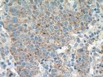 AVPI1 Antibody in Immunohistochemistry (Paraffin) (IHC (P))