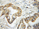 ERO1L Antibody in Immunohistochemistry (Paraffin) (IHC (P))