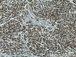ERO1L Antibody in Immunohistochemistry (Paraffin) (IHC (P))