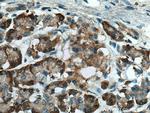 ERO1L Antibody in Immunohistochemistry (Paraffin) (IHC (P))