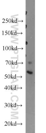 ERO1L Antibody in Western Blot (WB)