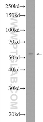 ERO1L Antibody in Western Blot (WB)
