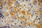 SERPINA6 Antibody in Immunohistochemistry (Paraffin) (IHC (P))
