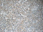 SERPINA6 Antibody in Immunohistochemistry (Paraffin) (IHC (P))