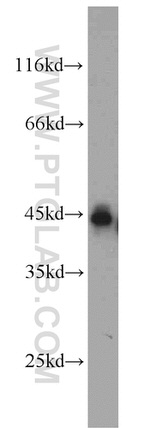 SMYD3 Antibody in Western Blot (WB)
