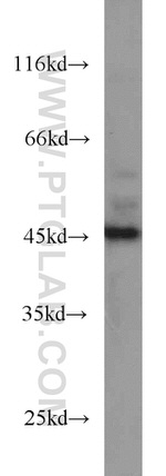 SMYD3 Antibody in Western Blot (WB)