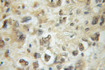 Exo70 Antibody in Immunohistochemistry (Paraffin) (IHC (P))