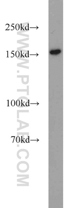 BAF170 Antibody in Western Blot (WB)