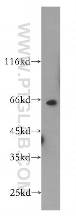 PRCC Antibody in Western Blot (WB)