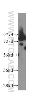 PRCC Antibody in Western Blot (WB)