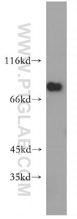 SPATA7 Antibody in Western Blot (WB)