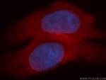 MYCBP Antibody in Immunocytochemistry (ICC/IF)