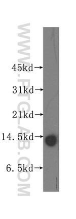 MYCBP Antibody in Western Blot (WB)