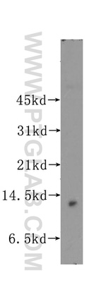 MYCBP Antibody in Western Blot (WB)