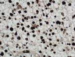 NUCKS1 Antibody in Immunohistochemistry (Paraffin) (IHC (P))