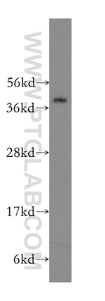 NUCKS1 Antibody in Western Blot (WB)