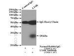 LY6K Antibody in Immunoprecipitation (IP)