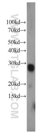 LY6K Antibody in Western Blot (WB)